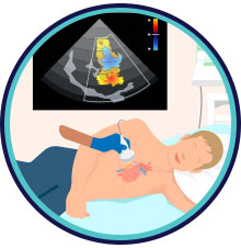 Echocardiogram Testing - Internal Medicine and Family Practice in Joliet, IL