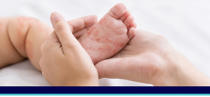 Measles Treatment Near Me in Joliet, IL Measles Treatment Near Me in Joliet, IL
