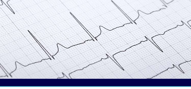 Echocardiogram Services Near Me in Joliet IL Echocardiogram Services Near Me in Joliet IL