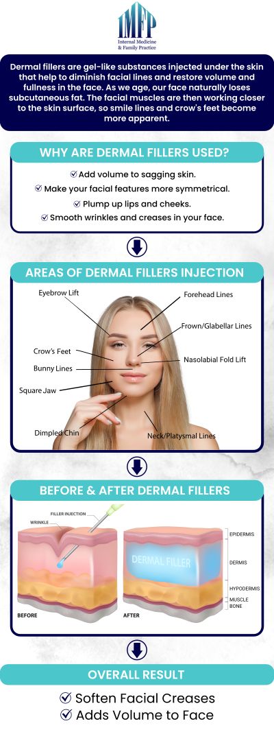 Common questions asked by clients: What are dermal fillers, and how do they work? What areas of the face can be treated with dermal fillers? How long do dermal fillers last? Are dermal fillers safe and what are the risks? For more information, contact us or schedule an appointment online. We are conveniently located at 1719 Glenwood Ave Joliet, IL 60435. We serve clients from Joliet IL, Plainfield IL, Lockport IL, Channahon IL, Romeoville IL, Manhattan IL and surrounding areas.