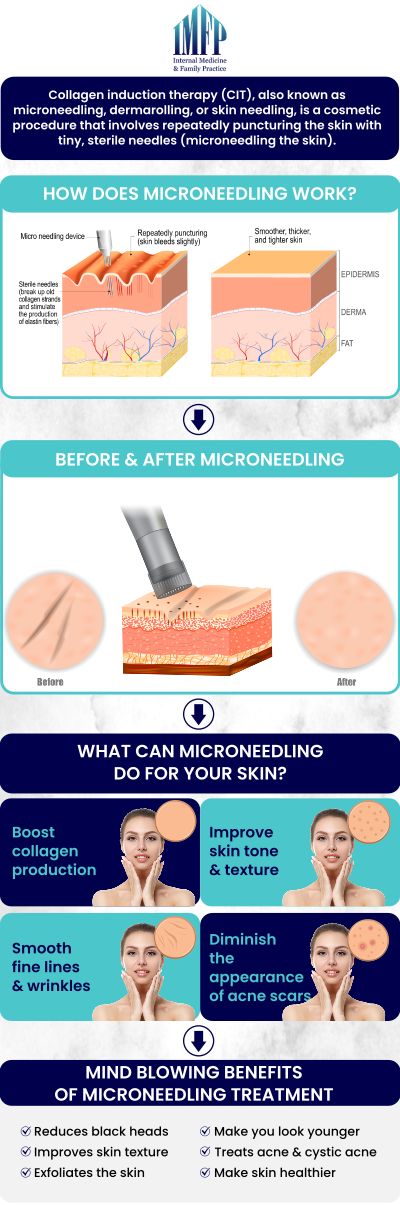 For more information, contact us or schedule an appointment online. We are conveniently located at 1719 Glenwood Ave Joliet, IL 60435.