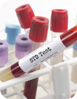 STD Testing Near Me in Joliet, IL
